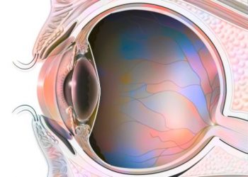Posterior Vitreous Detachment