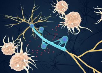 Sensory Regulation Disorder