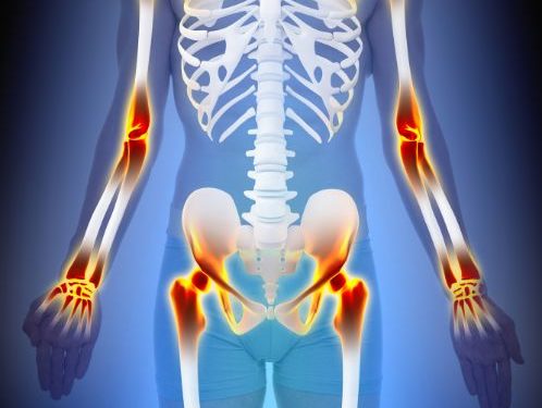 Skeleton Inflamation and Infection Symptoms