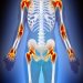 Skeleton Inflamation and Infection Symptoms