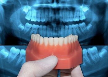 What Are Occlusion Symptoms?