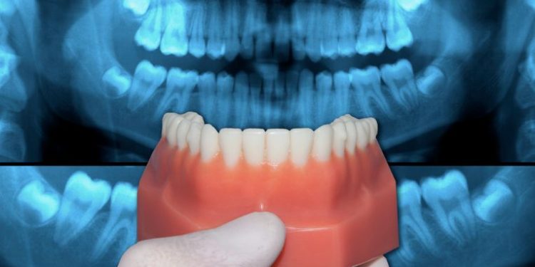 What Are Occlusion Symptoms?