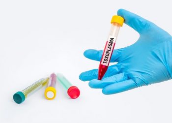 Toxoplasmosis Symptoms