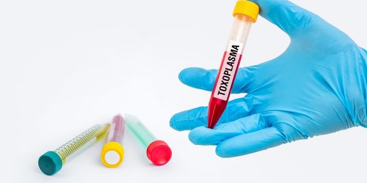 Toxoplasmosis Symptoms