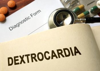 Dextrocardia Symptoms