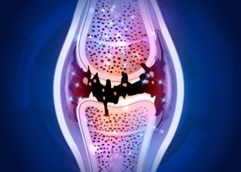 Foot and Lower Extremity Problems Symptoms