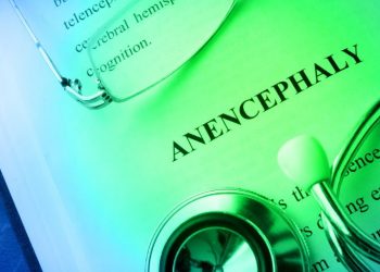 Anencephaly Symptoms