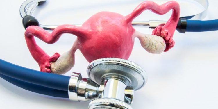 Endometrial Ablation