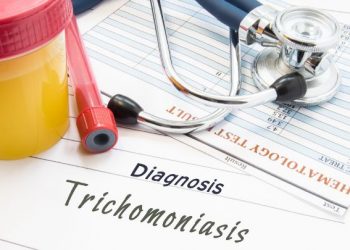 Trichomonas Symptoms
