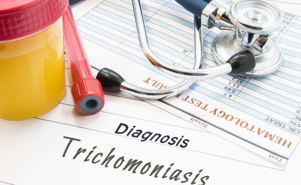 Trichomonas Symptoms