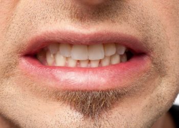 Teeth Grinding Symptoms