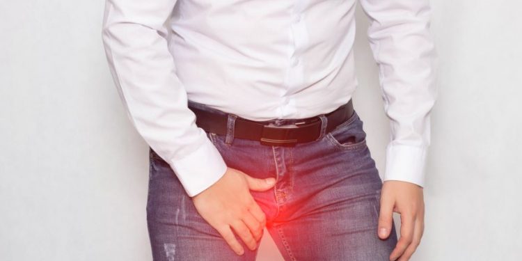 What Are Varicocele Symptoms?