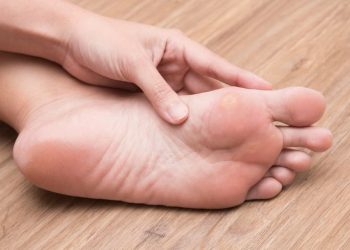 How to Prevent Calluses and Corns Symptoms