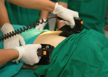 Ventricular Tachycardia Symptoms