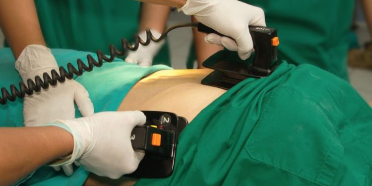 Ventricular Tachycardia Symptoms