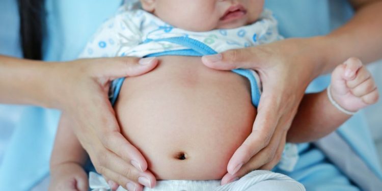 Recurrent Abdominal Pain in Children