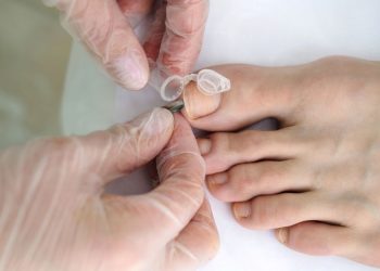 Symptoms of Fungal Infections