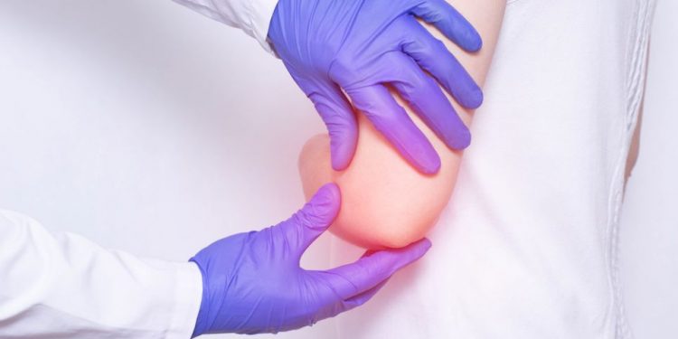 Epicondylitis Symptoms