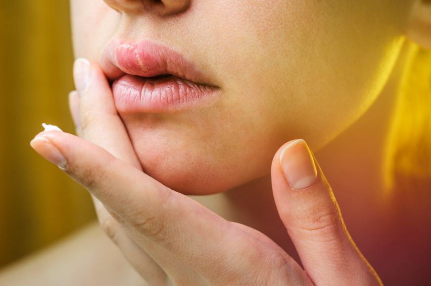 herpes-symptoms-news185