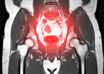 Hepatomegaly Symptoms and Causes