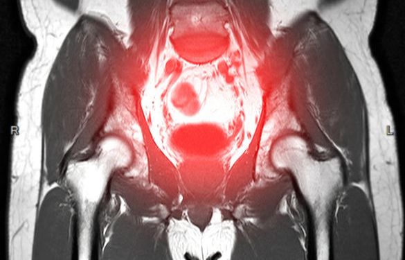 Hepatomegaly Symptoms and Causes