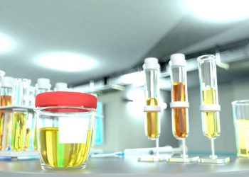 What Are Proteinuria Symptoms?