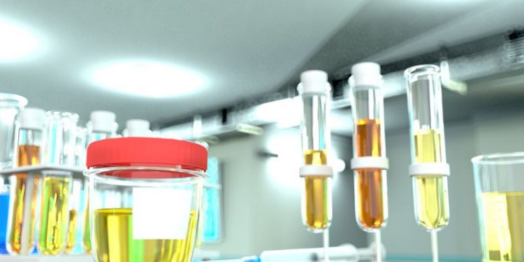 What Are Proteinuria Symptoms?