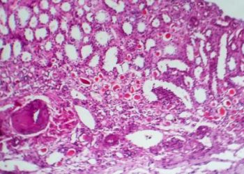 Renal Tubular Acidosis