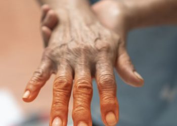 What Are the Symptoms of Burn Infections?