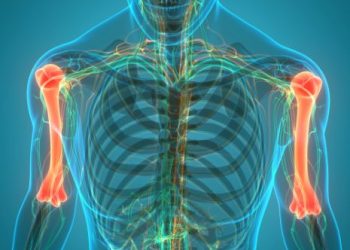 Osteopetrosis Symptoms