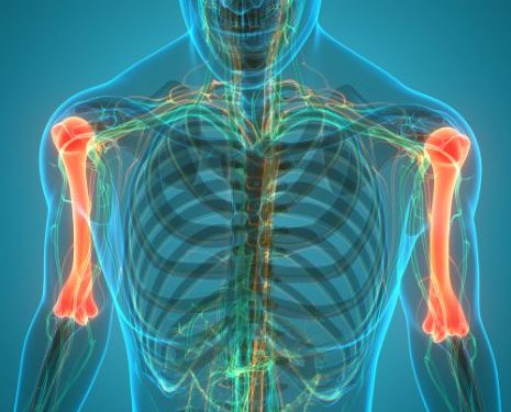 Osteopetrosis Symptoms