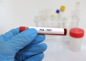 What to Do If You Have Elevated PSA Levels