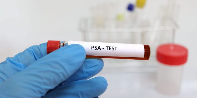 What to Do If You Have Elevated PSA Levels