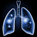 Lung Hernia