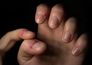 Neurotic Disorders Symptoms