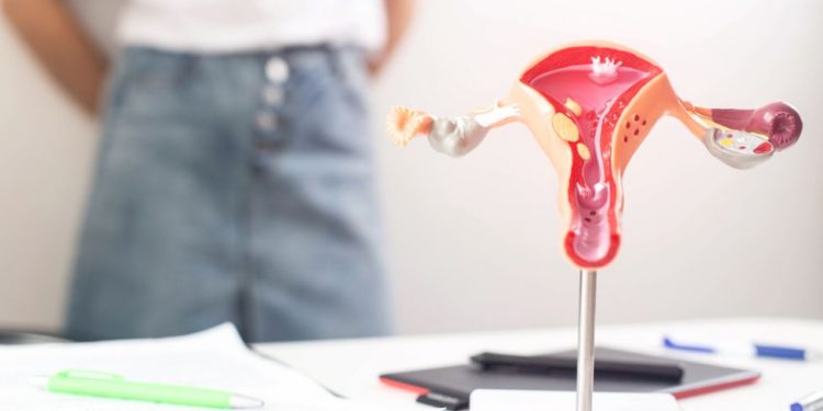 Menorrhagia Symptoms