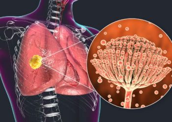Are Lung Fungi Workers Exposed to Climate Change?