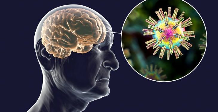 Cytomegalovirus Infection