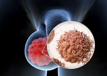 Testicular Pain Symptoms