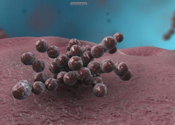 Legionnaires Disease and Pontiac Fever