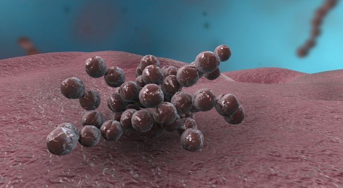 Legionnaires Disease and Pontiac Fever