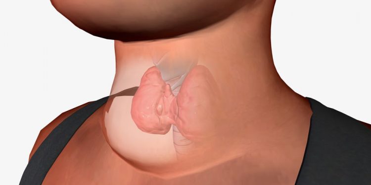 Cretinism Symptoms