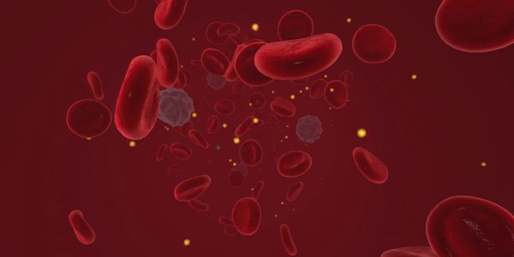 Causes and Symptoms of Hypercalcemia