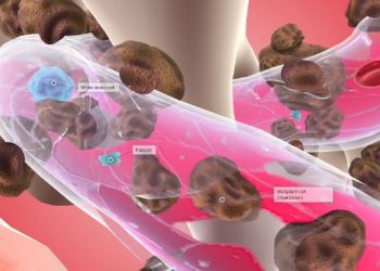 AML (Acute Myeloid Leukemia)