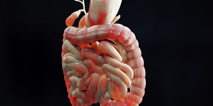 Intestinal Obstruction – Ileus Symptoms