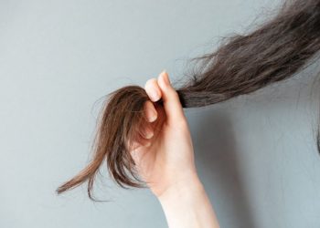 Trichotillomania Symptoms