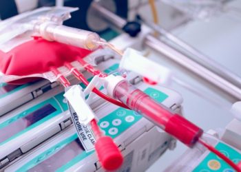 ALM Acute Lymphoblastic Leukemia