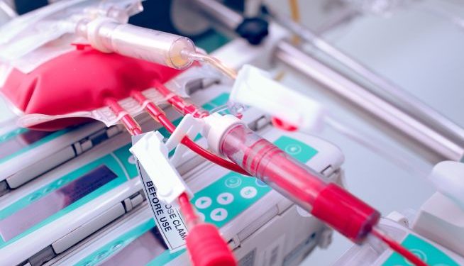ALM Acute Lymphoblastic Leukemia