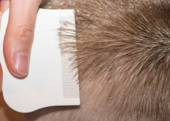 Lice Symptoms