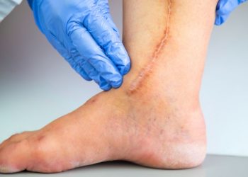 Postoperative Pain Symptoms and Treatments